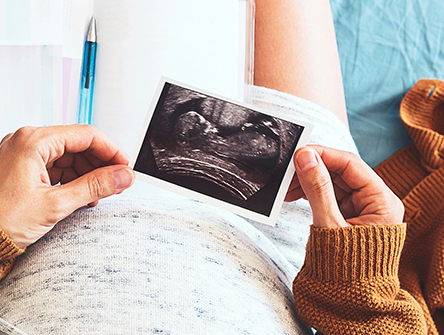 An aerial view of a pregnant woman looking at a photo of an ultrasound.