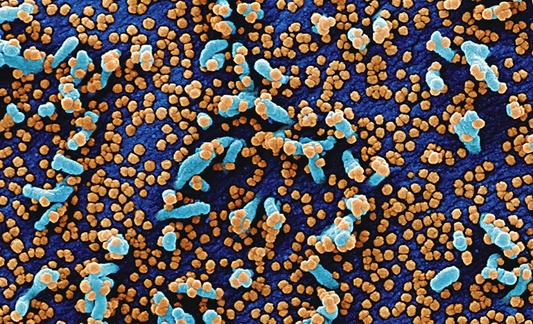 Novel Coronavirus SARS-CoV-2 viewed through a high-power microscope.
