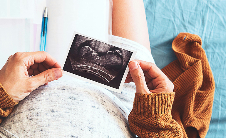 An aerial view of a pregnant woman looking at a photo of an ultrasound.